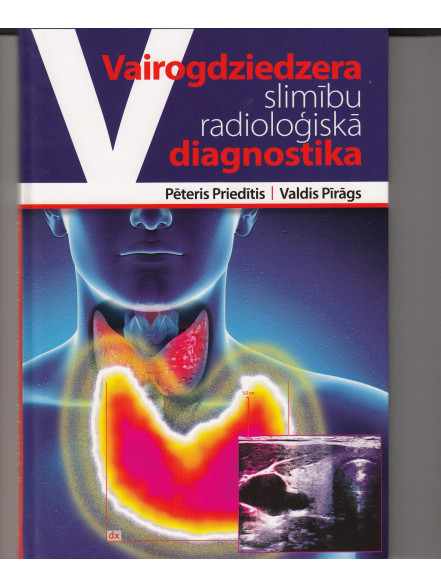 Vairogdziedzera slimību radioloģiskā diagnostika